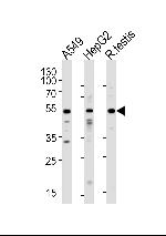 ACVR1 Antibody in Western Blot (WB)