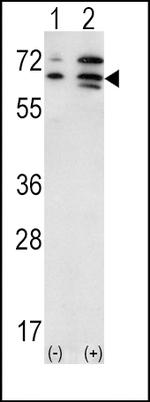 ACVR2A Antibody in Western Blot (WB)