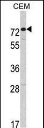 AMHR2 Antibody in Western Blot (WB)