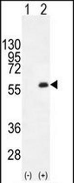 PKMYT1 Antibody in Western Blot (WB)