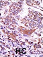 CaMKII delta Antibody in Immunohistochemistry (Paraffin) (IHC (P))