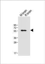 CaMKII delta Antibody in Western Blot (WB)