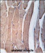 DAPK2 Antibody in Immunohistochemistry (Paraffin) (IHC (P))