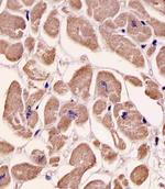 SPHK1 Antibody in Immunohistochemistry (Paraffin) (IHC (P))