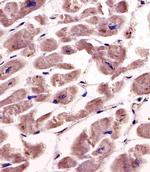 SPHK1 Antibody in Immunohistochemistry (Paraffin) (IHC (P))