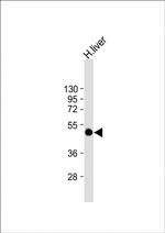 SPHK1 Antibody in Western Blot (WB)