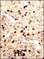 Aurora B Antibody in Immunohistochemistry (Paraffin) (IHC (P))