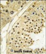 Aurora B Antibody in Immunohistochemistry (Paraffin) (IHC (P))