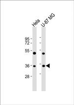 Aurora B Antibody in Western Blot (WB)