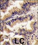 ERK2 Antibody in Immunohistochemistry (Paraffin) (IHC (P))