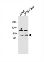 PLK2 Antibody in Western Blot (WB)