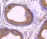 ALDH1A1 Antibody in Immunohistochemistry (Paraffin) (IHC (P))