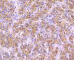 NSUN4 Antibody in Immunohistochemistry (Paraffin) (IHC (P))