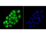 HDAC2 Antibody in Immunocytochemistry (ICC/IF)