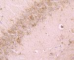 Cathepsin D Antibody in Immunohistochemistry (Paraffin) (IHC (P))