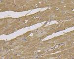 Beclin 1 Antibody in Immunohistochemistry (Paraffin) (IHC (P))