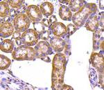 Prohibitin Antibody in Immunohistochemistry (Paraffin) (IHC (P))