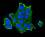 IGF2R Antibody in Immunocytochemistry (ICC/IF)