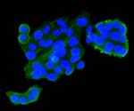 IGF2R Antibody in Immunocytochemistry (ICC/IF)