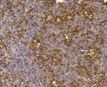 IGF2R Antibody in Immunohistochemistry (Paraffin) (IHC (P))