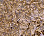 MCL-1 Antibody in Immunohistochemistry (Paraffin) (IHC (P))