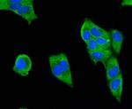 SMAD3 Antibody in Immunocytochemistry (ICC/IF)