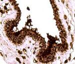 SMAD3 Antibody in Immunohistochemistry (Paraffin) (IHC (P))