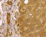 SMAD3 Antibody in Immunohistochemistry (Paraffin) (IHC (P))