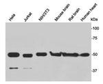 gamma Tubulin Antibody in Western Blot (WB)