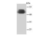 NSE Antibody in Western Blot (WB)