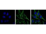 SQSTM1 Antibody in Immunocytochemistry (ICC/IF)