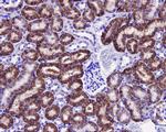 JNK1 Antibody in Immunohistochemistry (Paraffin) (IHC (P))