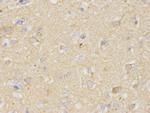 VDAC Antibody in Immunohistochemistry (Paraffin) (IHC (P))