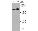 Clathrin Heavy Chain Antibody in Western Blot (WB)