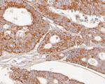 SLC15A1 Antibody in Immunohistochemistry (Paraffin) (IHC (P))