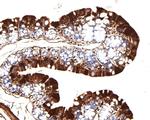 TIMM23 Antibody in Immunohistochemistry (Paraffin) (IHC (P))