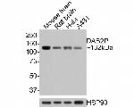 DAB2IP Antibody in Western Blot (WB)