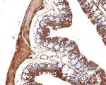 IRAK1 Antibody in Immunohistochemistry (Paraffin) (IHC (P))