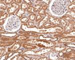 IL22RA2 Antibody in Immunohistochemistry (Paraffin) (IHC (P))