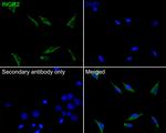 IFNGR2 Antibody in Immunocytochemistry (ICC/IF)