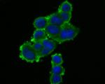 TRPV6 Antibody in Immunocytochemistry (ICC/IF)