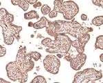 IL12RB1 Antibody in Immunohistochemistry (Paraffin) (IHC (P))