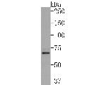 IL12RB1 Antibody in Western Blot (WB)