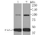 IL12RB2 Antibody in Western Blot (WB)