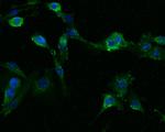 INHA Antibody in Immunocytochemistry (ICC/IF)