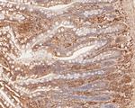 IL-28A Antibody in Immunohistochemistry (Paraffin) (IHC (P))