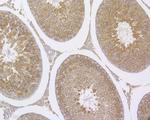 RANBP1 Antibody in Immunohistochemistry (Paraffin) (IHC (P))