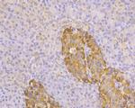 TMPRSS2 Antibody in Immunohistochemistry (Paraffin) (IHC (P))