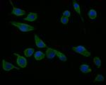 cGAS Antibody in Immunocytochemistry (ICC/IF)