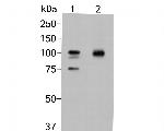 beta Galactosidase Antibody in Western Blot (WB)